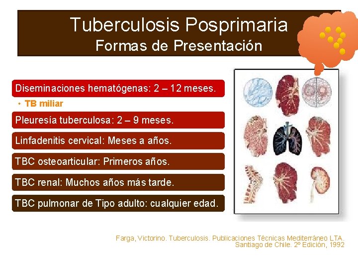 Tuberculosis Posprimaria Formas de Presentación Diseminaciones hematógenas: 2 – 12 meses. • TB miliar