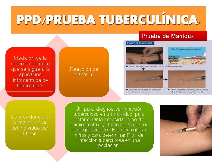 PPD/PRUEBA TUBERCULÍNICA Prueba de Mantoux Medición de la reacción dérmica que se sigue a