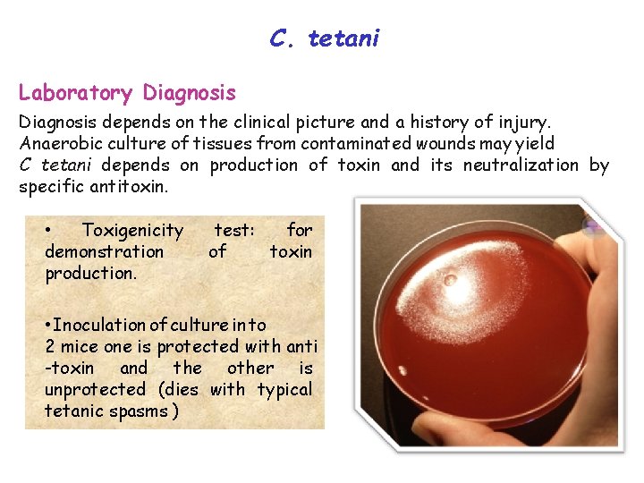 C. tetani Laboratory Diagnosis depends on the clinical picture and a history of injury.