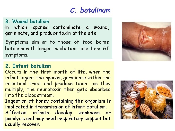 C. botulinum 3. Wound botulism in which spores contaminate a wound, germinate, and produce