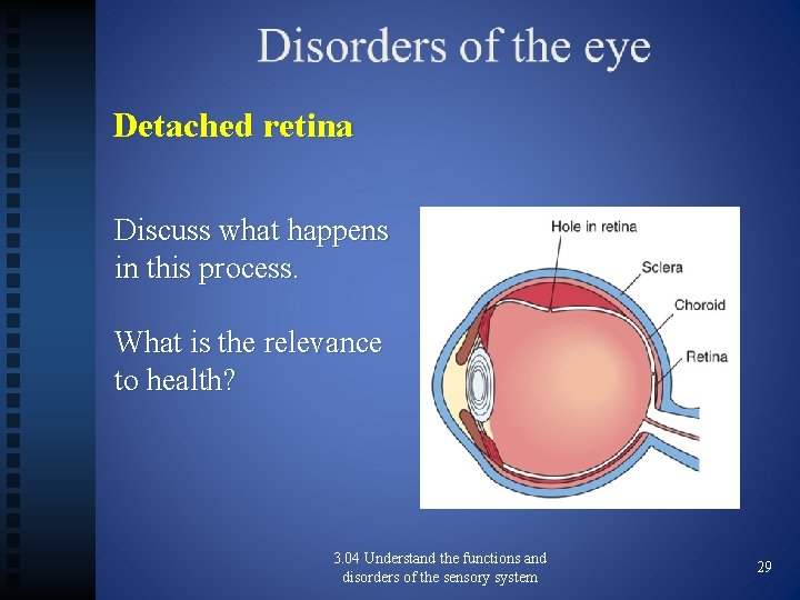 Detached retina Discuss what happens in this process. What is the relevance to health?