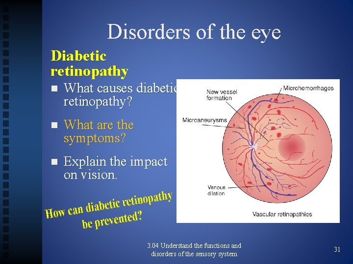 Disorders of the eye Diabetic retinopathy n What causes diabetic retinopathy? n What are