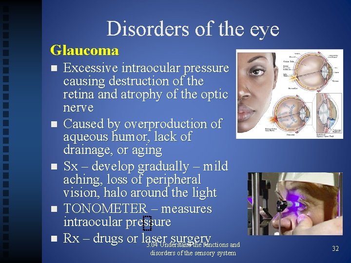 Disorders of the eye Glaucoma n n n Excessive intraocular pressure causing destruction of