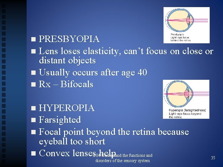 PRESBYOPIA n Lens loses elasticity, can’t focus on close or distant objects n Usually