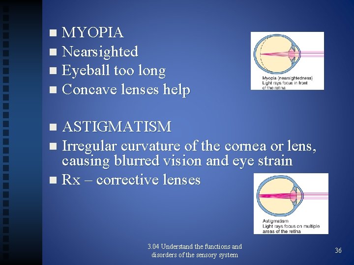MYOPIA n Nearsighted n Eyeball too long n Concave lenses help n ASTIGMATISM n