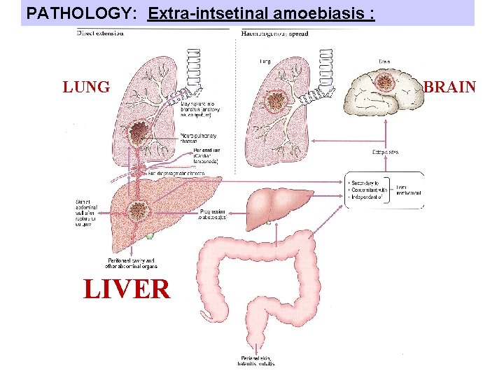 PATHOLOGY: Extra-intsetinal amoebiasis : LUNG LIVER BRAIN 