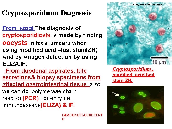 Cryptosporidium , safranin Cryptosporidium Diagnosis From stool The. diagnosis of cryptosporidiosis is made by