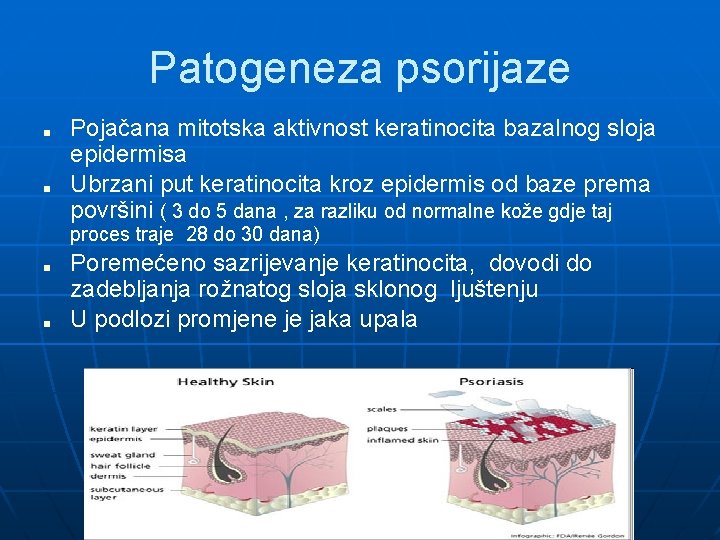 Patogeneza psorijaze ■ ■ Pojačana mitotska aktivnost keratinocita bazalnog sloja epidermisa Ubrzani put keratinocita