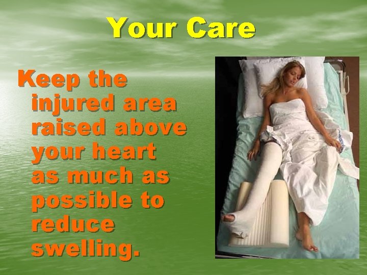 Your Care Keep the injured area raised above your heart as much as possible