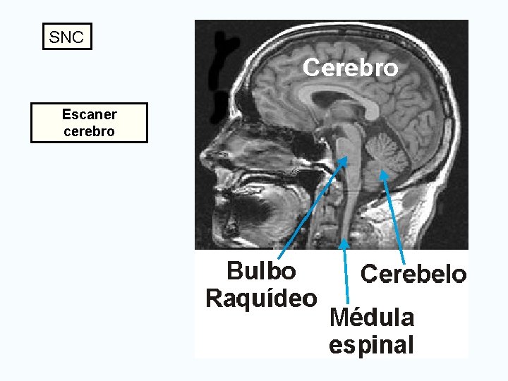 SNC Escaner cerebro 