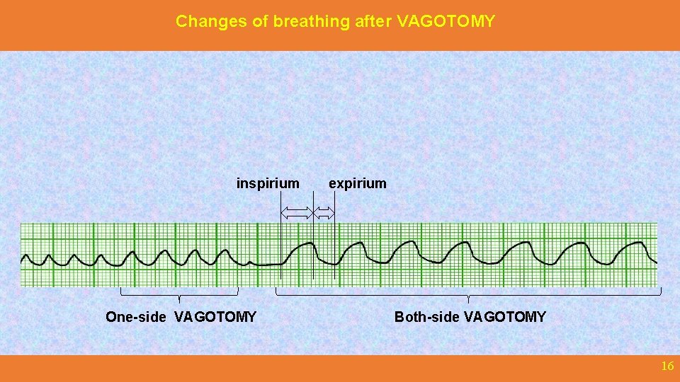 Changes of breathing after VAGOTOMY inspirium One-side VAGOTOMY expirium Both-side VAGOTOMY 16 