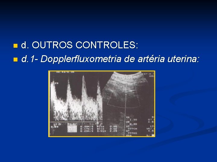 d. OUTROS CONTROLES: n d. 1 - Dopplerfluxometria de artéria uterina: n 