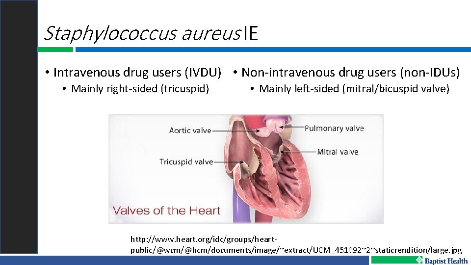 Staphylococcus aureus IE • Intravenous drug users (IVDU) • Non-intravenous drug users (non-IDUs) •