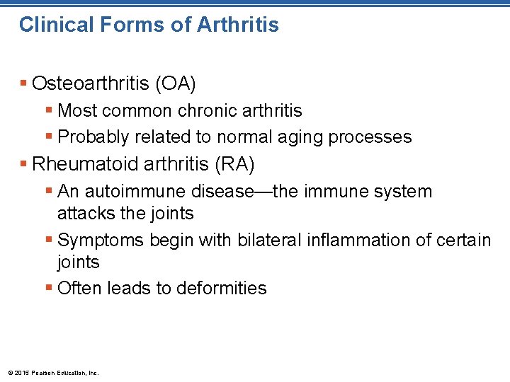 Clinical Forms of Arthritis § Osteoarthritis (OA) § Most common chronic arthritis § Probably