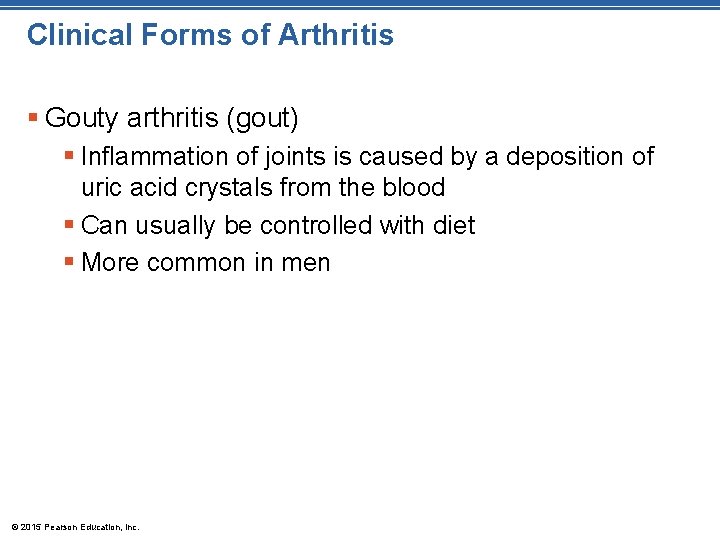 Clinical Forms of Arthritis § Gouty arthritis (gout) § Inflammation of joints is caused