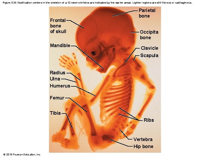 Figure 5. 34 Ossification centers in the skeleton of a 12 -week-old fetus are