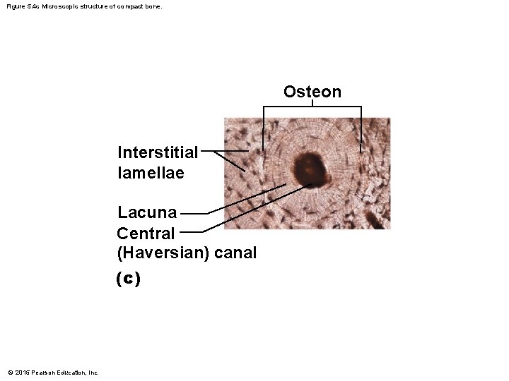 Figure 5. 4 c Microscopic structure of compact bone. Osteon Interstitial lamellae Lacuna Central