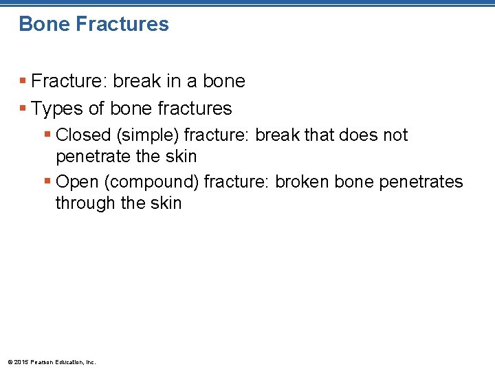 Bone Fractures § Fracture: break in a bone § Types of bone fractures §
