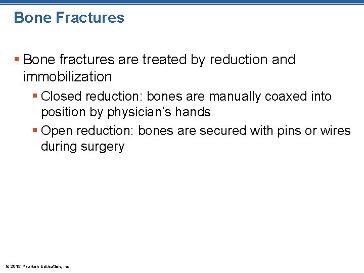 Bone Fractures § Bone fractures are treated by reduction and immobilization § Closed reduction: