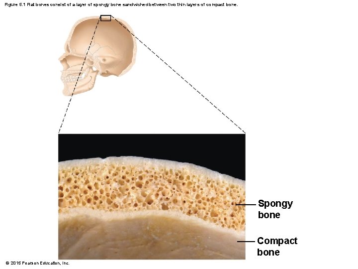 Figure 5. 1 Flat bones consist of a layer of spongy bone sandwiched between