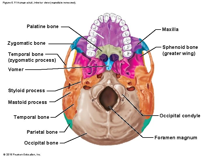 Figure 5. 11 Human skull, inferior view (mandible removed). Palatine bone Zygomatic bone Temporal