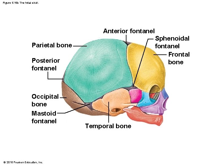Figure 5. 15 b The fetal skull. Parietal bone Posterior fontanel Occipital bone Mastoid