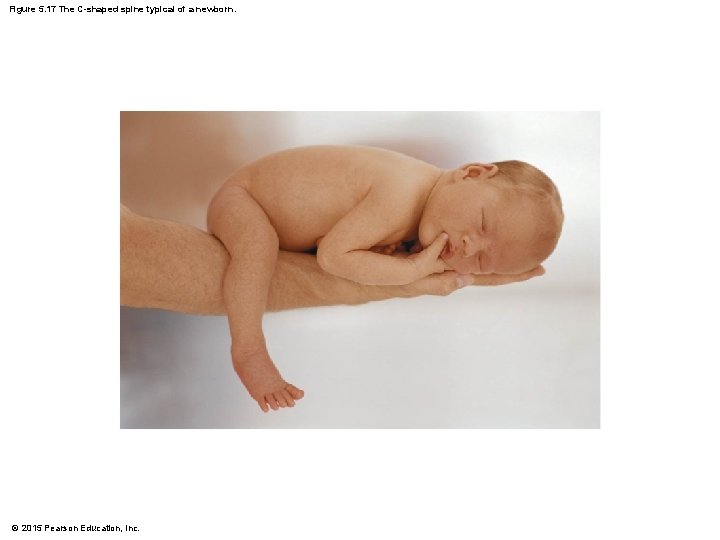 Figure 5. 17 The C-shaped spine typical of a newborn. © 2015 Pearson Education,