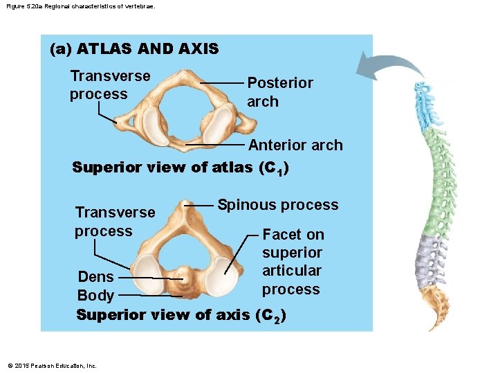 Figure 5. 20 a Regional characteristics of vertebrae. (a) ATLAS AND AXIS Transverse process