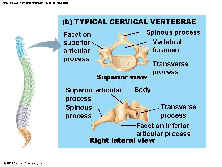 Figure 5. 20 b Regional characteristics of vertebrae. (b) TYPICAL CERVICAL VERTEBRAE Spinous process