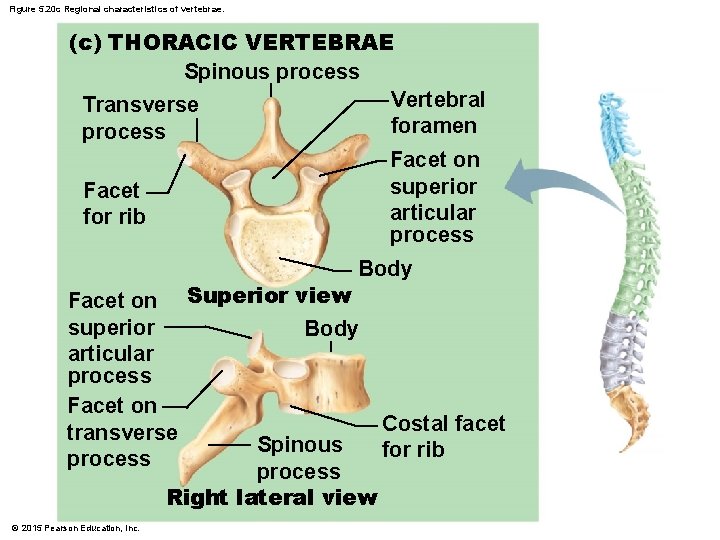 Figure 5. 20 c Regional characteristics of vertebrae. (c) THORACIC VERTEBRAE Spinous process Vertebral