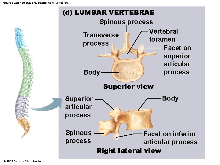 Figure 5. 20 d Regional characteristics of vertebrae. (d) LUMBAR VERTEBRAE Spinous process Vertebral