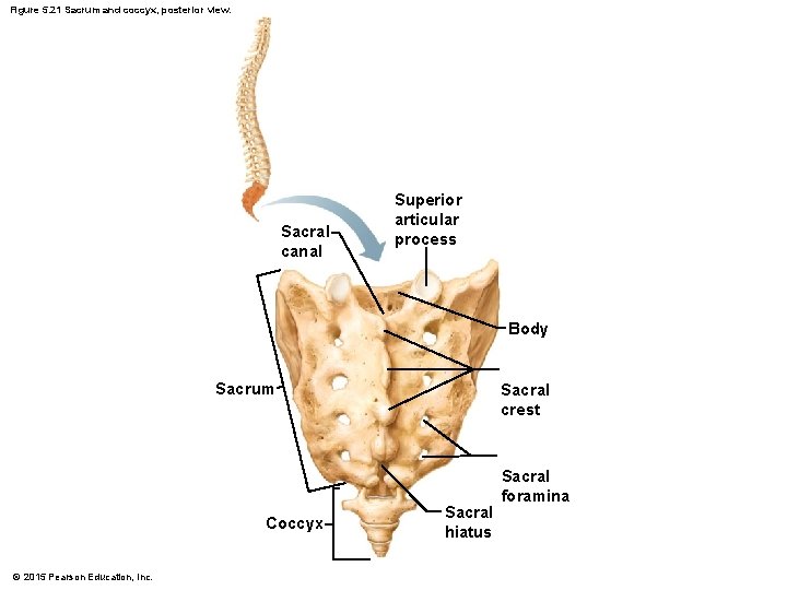 Figure 5. 21 Sacrum and coccyx, posterior view. Sacral canal Superior articular process Body