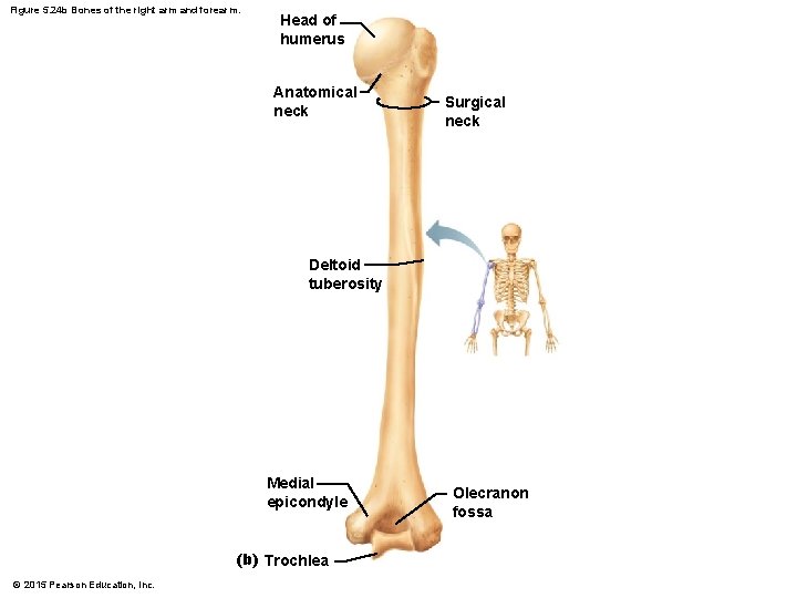 Figure 5. 24 b Bones of the right arm and forearm. Head of humerus