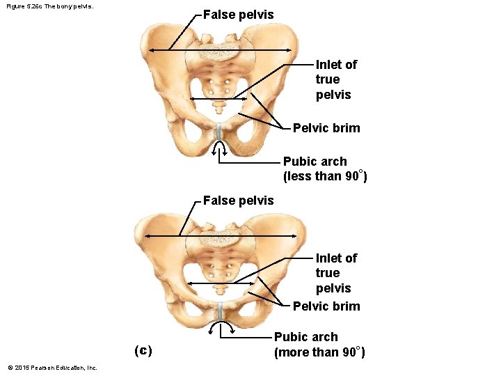 Figure 5. 26 c The bony pelvis. False pelvis Inlet of true pelvis Pelvic