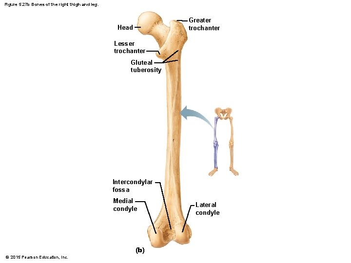 Figure 5. 27 b Bones of the right thigh and leg. Greater trochanter Head
