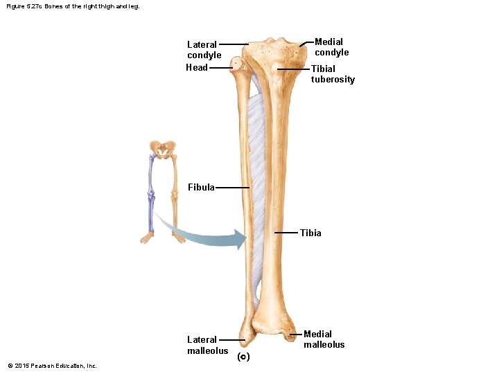 Figure 5. 27 c Bones of the right thigh and leg. Medial condyle Lateral