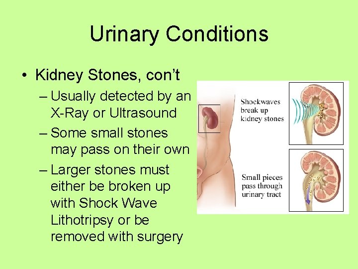 Urinary Conditions • Kidney Stones, con’t – Usually detected by an X-Ray or Ultrasound
