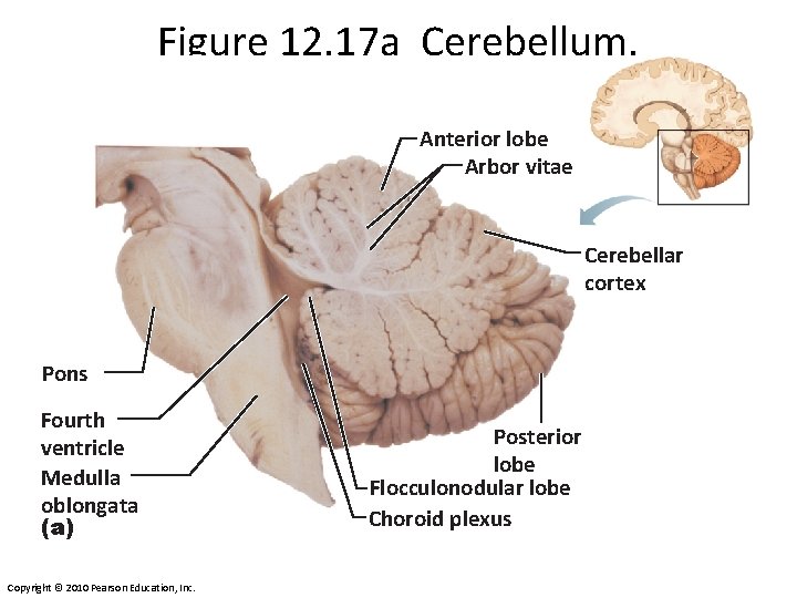 Figure 12. 17 a Cerebellum. Anterior lobe Arbor vitae Cerebellar cortex Pons Fourth ventricle