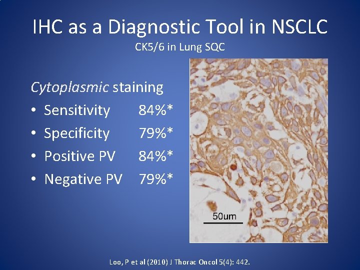 IHC as a Diagnostic Tool in NSCLC CK 5/6 in Lung SQC Cytoplasmic staining