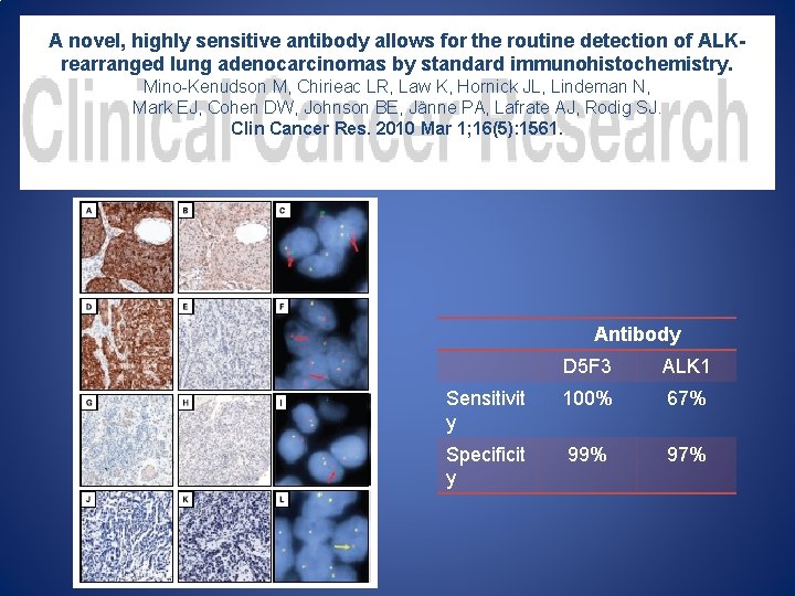 A novel, highly sensitive antibody allows for the routine detection of ALKrearranged lung adenocarcinomas