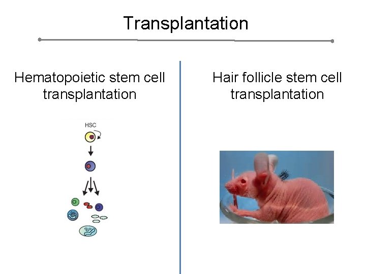 Transplantation Hematopoietic stem cell transplantation Hair follicle stem cell transplantation 