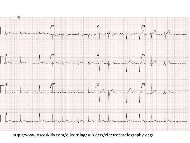 http: //www. osceskills. com/e-learning/subjects/electrocardiography-ecg/ 