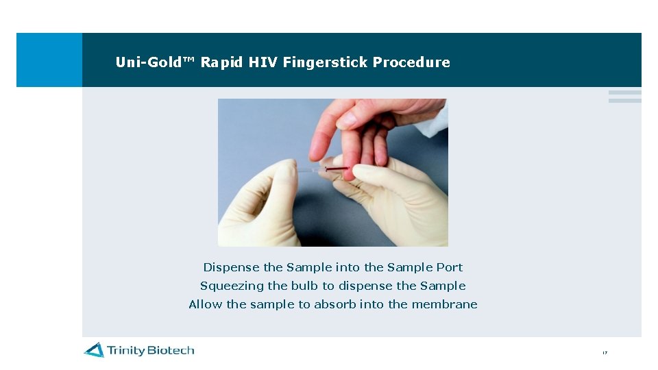 Uni-Gold™ Rapid HIV Fingerstick Procedure Dispense the Sample into the Sample Port Squeezing the