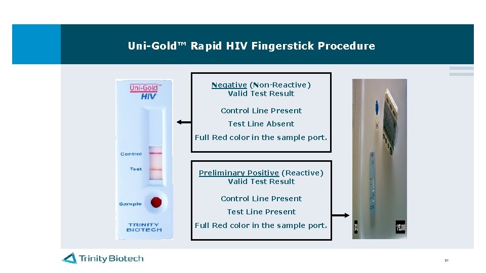Uni-Gold™ Rapid HIV Fingerstick Procedure Negative (Non-Reactive) Valid Test Result Control Line Present Test