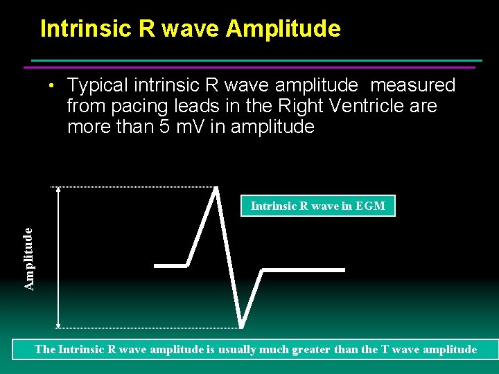 Intrinsic R wave Amplitude • Typical intrinsic R wave amplitude measured from pacing leads Intrinsic R wave Amplitude • Typical intrinsic R wave amplitude measured from pacing leads