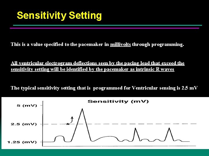Sensitivity Setting This is a value specified to the pacemaker in millivolts through programming.