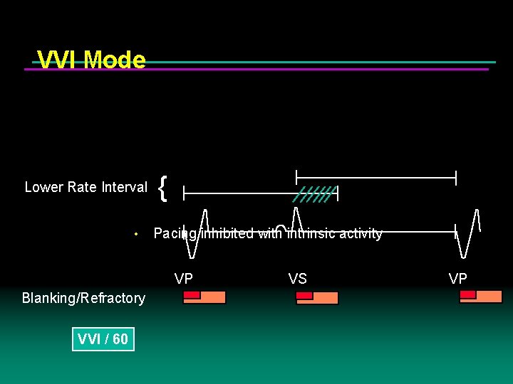 VVI Mode Lower Rate Interval • { Pacing inhibited with intrinsic activity VP Blanking/Refractory