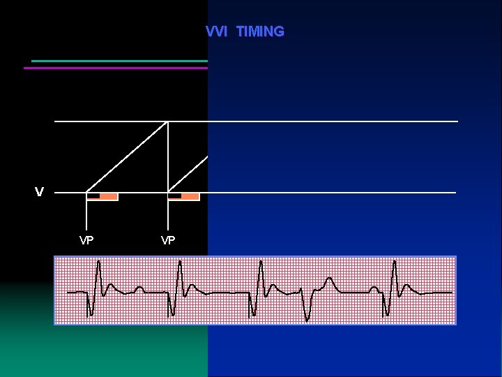 VVI TIMING V VP VP VP VS VP 