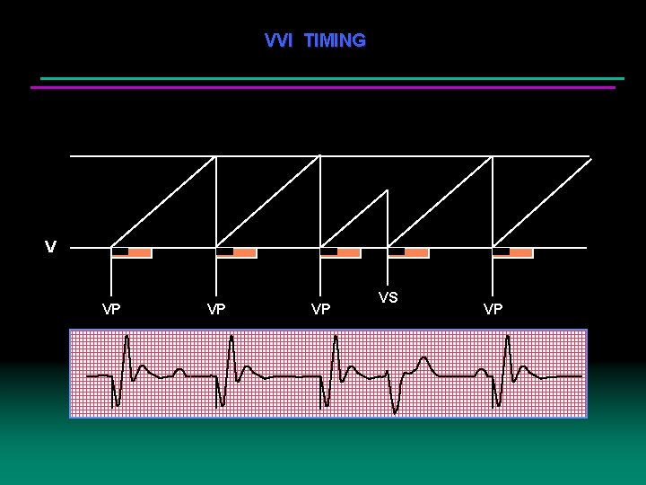 VVI TIMING V VP VP VP VS VP 