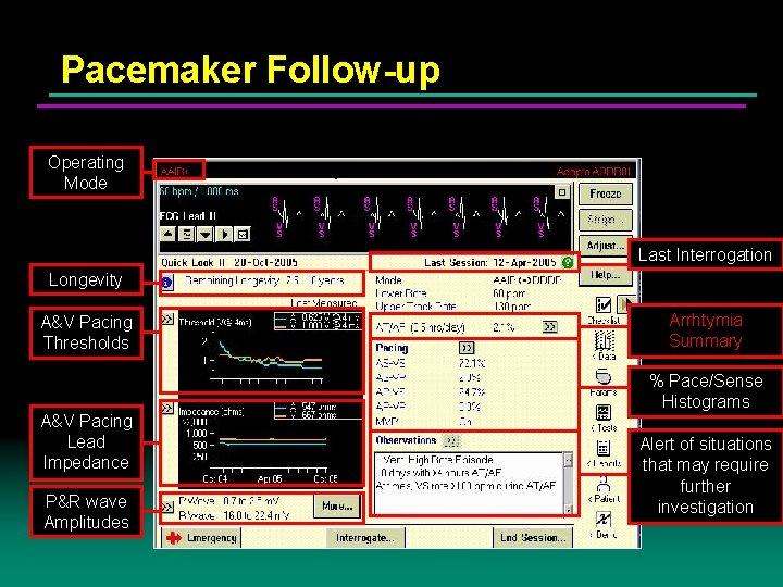 Pacemaker Follow-up • All the Information for Routine Follow-ups Operating Mode Last Interrogation Longevity